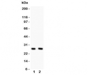 Western blot testing of Olig1 antibody and Lane 1:  U87;  2: HeLa lysate