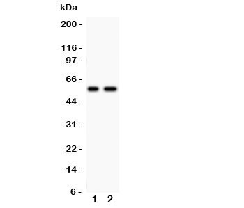 Western blot testing of PIASg antibody and Lane 1: human placenta; 2: A431 lysate. Expected/observed size ~56KD