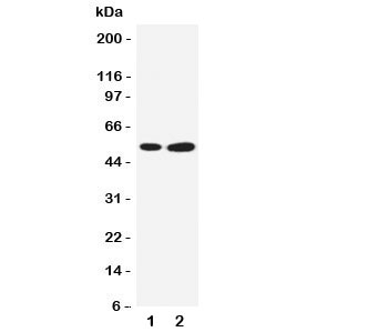 Western blot testing of SBP antibody and Lane 1: COLO320; 2: PANC cell lysate~