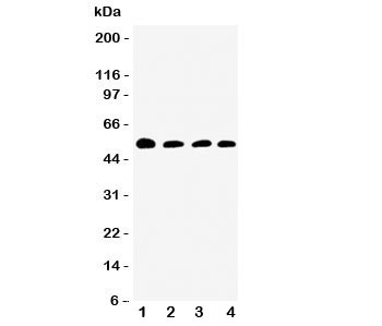 Western blot testing of Antithrombin III antibody and Lane 1: rat testis; 2: SMMC-7721; 3: Jurkat; 4: Raji cell lysate. Expected/observed size ~52KD