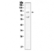 Western blot testing of rat kidney tissue lysate with SLC9A2 antibody.  Expected molecular weight ~92 kDa.