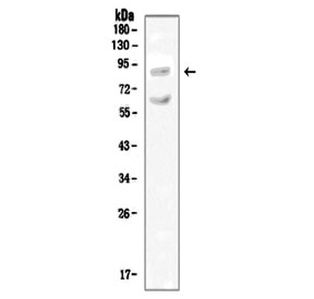 Western blot testing of rat kidney tissue lysate with SLC9A2 antibody.  Expected molecular weight ~92 kDa.