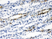 IHC staining of FFPE rat kidney tissue with SLC9A2 antibody. HIER: boil tissue sections in pH6 citrate buffer for 20 min and allow to cool before testing.