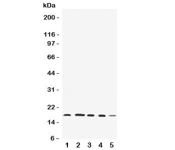 Western blot testing of FAT10 antibody and Lane 1: HeLa; 2: SKOV; 3: MCF-7; 4: A549; 5: SMMC-7721 cell lysate. Expected/observed size ~18KD