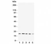 Western blot testing of FAT10 antibody and Lane 1:  HeLa;  2: SKOV;  3: MCF-7;  4: A549;  5: SMMC-7721 cell lysate.  Expected/observed size: 18-22 kDa.