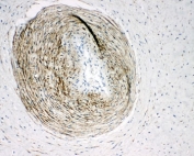 IHC-P: Calponin antibody testing of human placental tissue. HIER: steam section in pH6 citrate buffer for 20 min and allow to cool prior to testing.