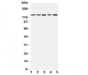 Western blot testing of Integrin alpha 7 antibody and Lane 1:  293T;  2: A431;  3: HeLa;  4: Jurkat;  5: Raji cell lysate.  Expected/observed size ~129KD