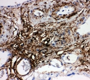 IHC-P: PLTP antibody testing of human placenta tissue