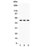 Western blot testing of PLTP antibody and 1. MCF7, 2. Raji and 3. HeLa lysate.  Expected/observed size ~55KD