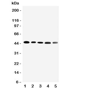 Western blot testing of CBG antibody and Lane 1: HeLa; 2: A431; 3: U87; 4: 22RV1; 5: PANC cell lysate. Expected/observed size ~45KD~