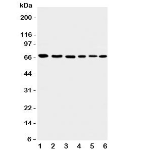 Western blot testing of Apoptosis-Inducing Factor antibody and Lane 1: rat heart; 2: (r) brain; 3: human K562; 4: (h) HEPG2; 5: (h) A431; 6: mouse NIH3T3 cell lysate. Expected/observed size ~67KD
