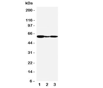 Western blot testing of GPR30 antibody and Lane 1: human COLO320; 2: (h) MCF-7; 3: monkey COS7 cell lysate. Expected size (unglycosylated) ~40KD, glycosylated size ~60KD