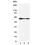 Western blot testing of GPR30 antibody and Lane 1:  human COLO320;  2: human MCF-7;  3: monkey COS7 cell lysate.  Expected molecular weight: 40-60 kDa depending on glycosylation level.
