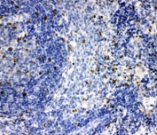 IHC-P: IRAK2 antibody testing of rat spleen tissue