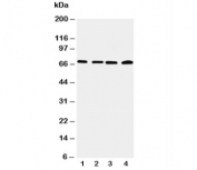 Western blot testing of IRAK2 antibody and Lane 1:  22RV;  2: A549;  3: PANC;  4: SMMC-7721 cell lysate