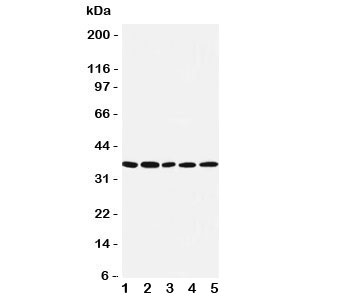 Western blot testing of IRF1 antibody and Lane 1: COLO320; 2: U87; 3: HeLa; 4: Jurkat; 5: MCF-7 cell lysate~