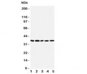 Western blot testing of IRF1 antibody and human lysates from 1:  COLO320;  2: U87;  3: HeLa;  4: Jurkat;  5: MCF-7 cells. Expected molecular weight: ~37 kDa (unmodified), 45-50 kDa (modified).