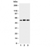 Western blot testing of KIN17 antibody and Lane 1:  rat skeletal muscle;  2: human placenta;  3: rat testis tissue lysate. Predicted molecular weight ~45kDa.