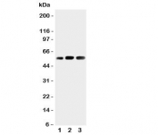 Western blot testing of KIN17 antibody and Lane 1:  rat skeletal muscle;  2: human placenta;  3: rat testis tissue lysate. Predicted molecular weight ~45kDa.