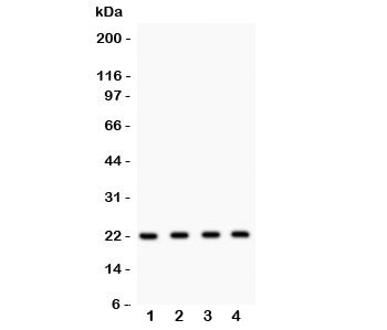 Western blot testing of Securin antibody and Lane 1: HeLa; 2: MCF-7; 3: SKOV; 4: A375 lysate. Expected/observed size ~22KD