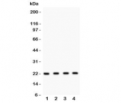 Western blot testing of Securin antibody and Lane 1:  HeLa;  2: MCF-7;  3: SKOV;  4: A375 lysate. Predicted molecular weight ~22 kDa, can be observed at 25-30 kDa.