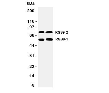 Western blot testing of RGS9 antibody and Lane 1: rat brain; 2: mouse brain tissue lysate. Expected/observed sizes: 57KD and/or 77KD