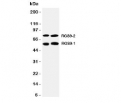 Western blot testing of RGS9 antibody and Lane 1:  rat brain;  2: mouse brain tissue lysate.  Predicted molecular weight: 50-77 kDa (multiple isoforms).