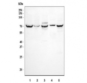 Western blot testing of 1) human HepG2, 2) human 293T, 3) rat kidney, 4) rat NRK and 5) mouse kidney tissue lysate with SGLT1 antibody.  Expected molecular weight: ~73 kDa.