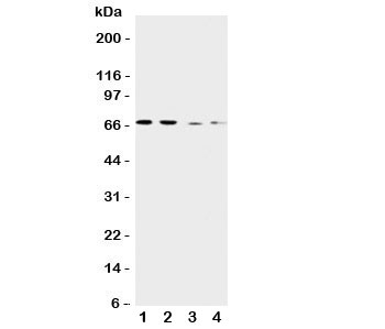 Western blot testing of CAT1 antibody and Lane 1: human placenta; 2: HeLa; 3: SKOV-3; 4: HT1080 cell lysate. Expected/observed size ~68KD