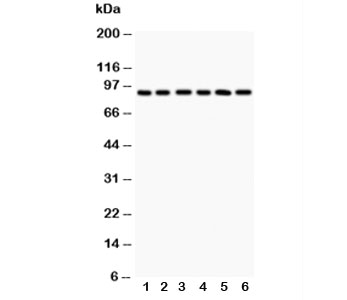 Western blot testing of TLR1 antibody and Lane 1: COLO320; 2: SW620; 3: SKOV; 4: Jurkat; 5: CEM; 6: PANC lysate