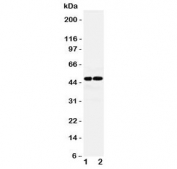 Western blot testing of AVPR1A antibody and Lane 1:  rat liver lysate;  2: rat kidney lysate.  Expected molecular weight: 47-85 kDa depending on glycosylation level.