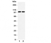 Western blot testing of GLUR3 antibody and Lane 1:  rat brain;  2: mouse brain lysate.  Predicted/observed size ~99KD