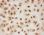 ICC testing of PIAS1 antibody and A549 cells