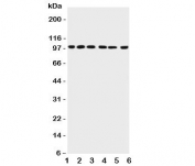 Western blot testing of PIAS1 antibody and Lane 1:  rat testis;  2: mouse testis;  3: human HeLa;  4: (h) Jurkat;  5: (h) MCF-7;  6: (h) SKOV lysate;  Expected size: 72~100KD