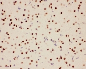 IHC-P: PIAS1 antibody testing of rat brain tissue