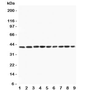 Western blot testing of PON1 antibody and Lane 1: rat liver; 2: (r) lung; 3: human placenta; 4: (r) testis; 5: (h) HeLa; 6: mouse HEPA; 7: (h) A549; 8: (h) Jurkat; 9: (h) SKOV lysate. Expected/observed size ~40KD