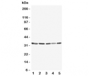 Western blot testing of TNFAIP8L3 antibody and Lane 1:  MCF-7;  2: SW620;  3: COS7;  4: SKOV;  5: Jurkat lysate.  Predicted/observed size ~33KD