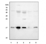 Western blot testing of 1) human placenta, 2) human K562, 3) human HepG2, 4) rat brain and 5) rat kidney tissue lysate with UBC9 antibody.  Predicted molecular weight ~18 kDa.