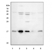 Western blot testing of UBC9 antibody and rat samples 1: heart;  2: skeletal muscle;  3: pancreas lysate.  Predicted/expected size ~18KD