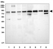 Western blot testing of 1) human HeLa, 2) human HepG2, 3) human K562, 4) human Jurkat, 5) rat kidney, 6) mouse kidney, 7) mouse spleen and 8) mouse SP2/0 cell lysate with ATG7 antibody. Predicted molecular weight: 70-80 kDa.