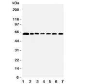 Western blot testing of PRMT4 antibody and Lane 1:  rat spleen;  2: human placenta;  3: (r) kidney;  4: mouse NIH3T3;  5: (h) HeLa;  6: (h) HL60;  7: (h) Jurkat lysate