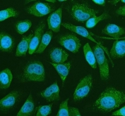 Immunofluorescent staining of FFPE human HeLa cells with PRMT4 antibody (green) and DAPI nuclear stain (blue). HIER: steam section in pH6 citrate buffer for 20 min.