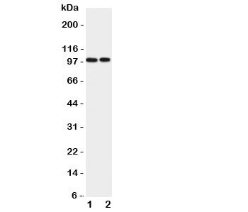 Western blot testing of EPB41L1 antibody and Lane 1: rat brain; 2: mouse brain lysate. Predicted/observed size ~99KD