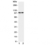 Western blot testing of EPB41L1 antibody and Lane 1:  rat brain;  2: mouse brain lysate.  Predicted/observed size ~99KD
