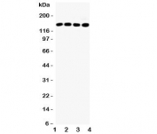 Western blot testing of IRS-1 antibody and Lane 1:  HeLa;  2: A549;  3: 293T;  4: MCF-7 lysate,  Expected size: 132~185KD depending on serine phosphorylation level