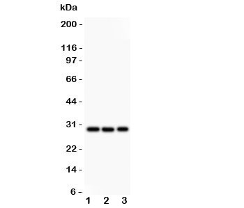 Western blot testing of CSEN antibody and Lane 1: HeLa; 2: U87; 3: SHG-44 lysate. Predicted/observed size ~29KD