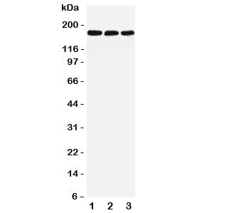 Western blot testing of LRP5 antibody and Lane 1: rat liver; 2: mouse liver; 3: (m) NIH3T3 lysate