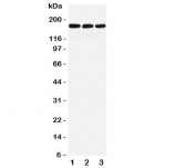 Western blot testing of LRP5 antibody and Lane 1:  rat liver;  2: mouse liver;  3: (m) NIH3T3 lysate. Predicted molecular weight ~179 kDa.