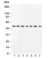 Western blot testing of MEK2 antibody and Lane 1: rat skeletal muscle;  2: rat kidney; and human samples 3: HeLa;  4: COLO320;  5: PC12;  6: Jurkat;  7: HT1080 lysate.  Observed molecular weight ~50kDa.