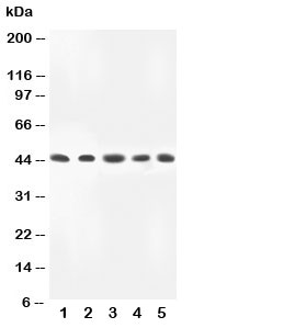 Western blot testing of MKK4 antibody and Lane 1: rat skeletal muscle; 2: HeLa; 3: A549; 4: MM231; 5: CEM lysate. Predicted/observed size ~44KD